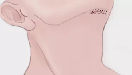 세포 분리기 사용하여 분리