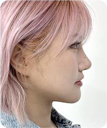 맥미걸 악플콜렉터 Before후 사진