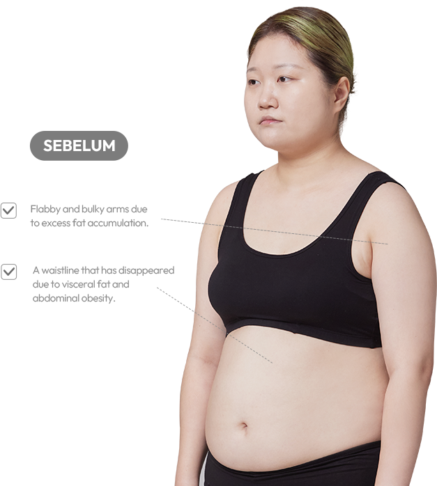 맥미걸 악플콜렉터 바디 수술 전 문제점과 개선점