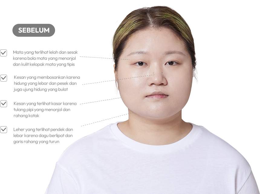 맥미걸 악플콜렉터 얼굴 수술 전 문제점과 개선점