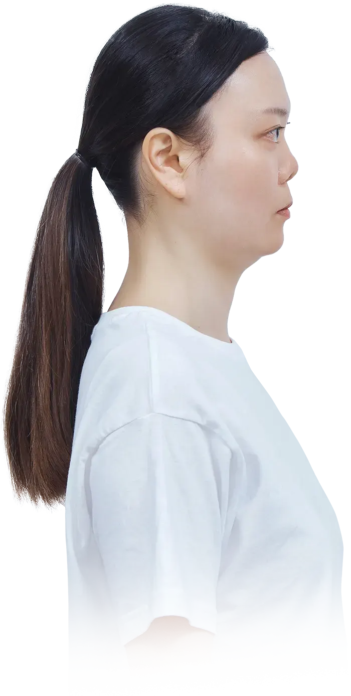 맥미걸 악플콜렉터 Before