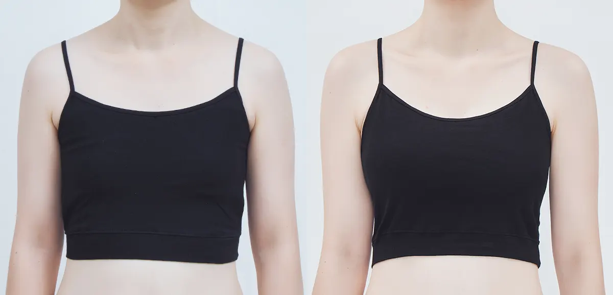 Before and After Surgery