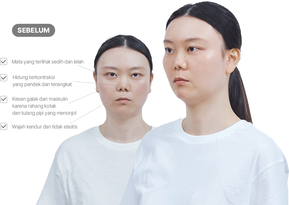 맥미걸 악플콜렉터 얼굴 수술 전 문제점과 개선점