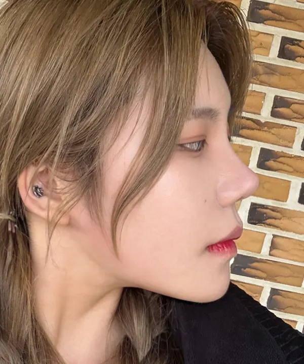 맥미걸 악플콜렉터 Before후 사진