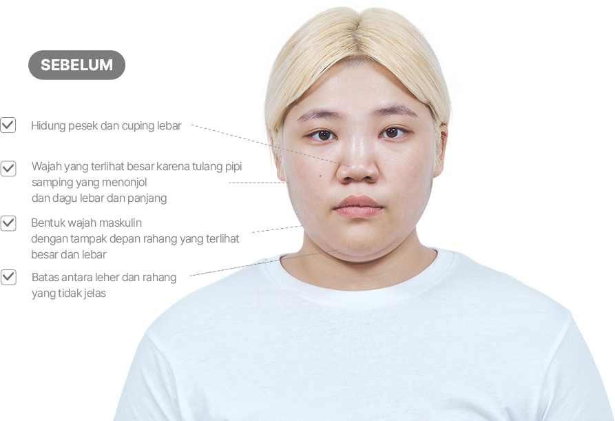 맥미걸 악플콜렉터 얼굴 수술 전 문제점과 개선점