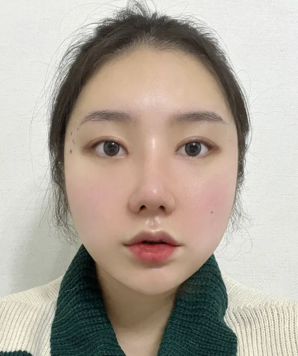 맥미걸 악플콜렉터 Before후 사진