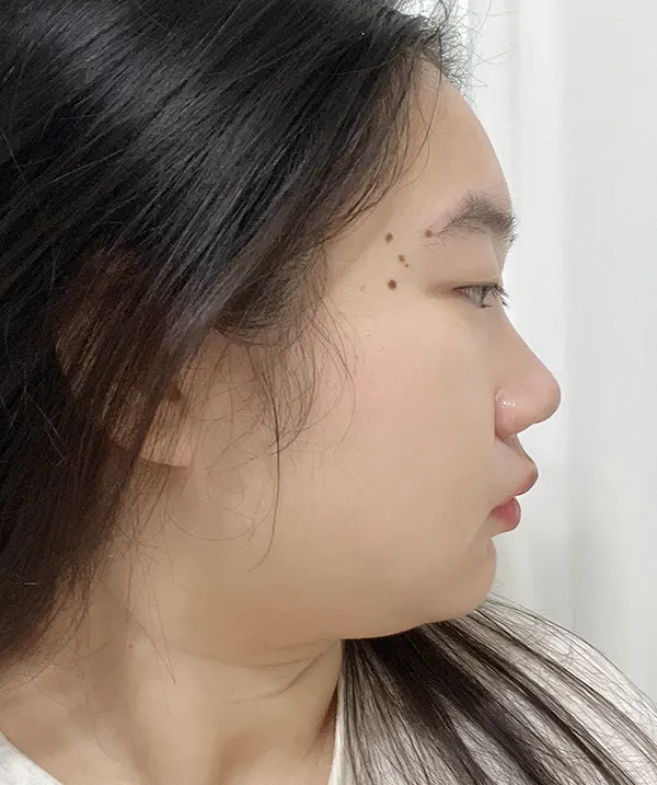 맥미걸 악플콜렉터 Before후 사진