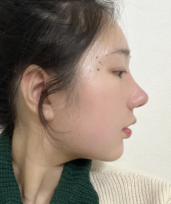 맥미걸 악플콜렉터 Before후 사진