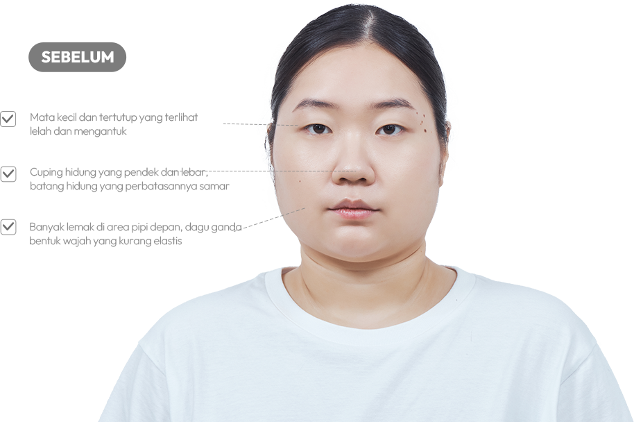 맥미걸 악플콜렉터 얼굴 수술 전 문제점과 개선점