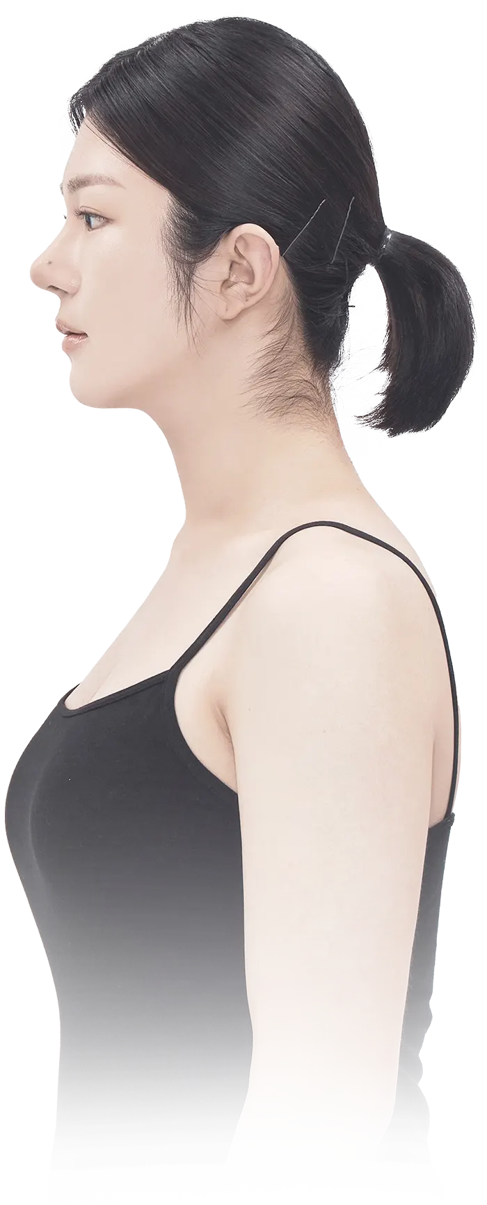 맥미걸 악플콜렉터 수술 후 변화