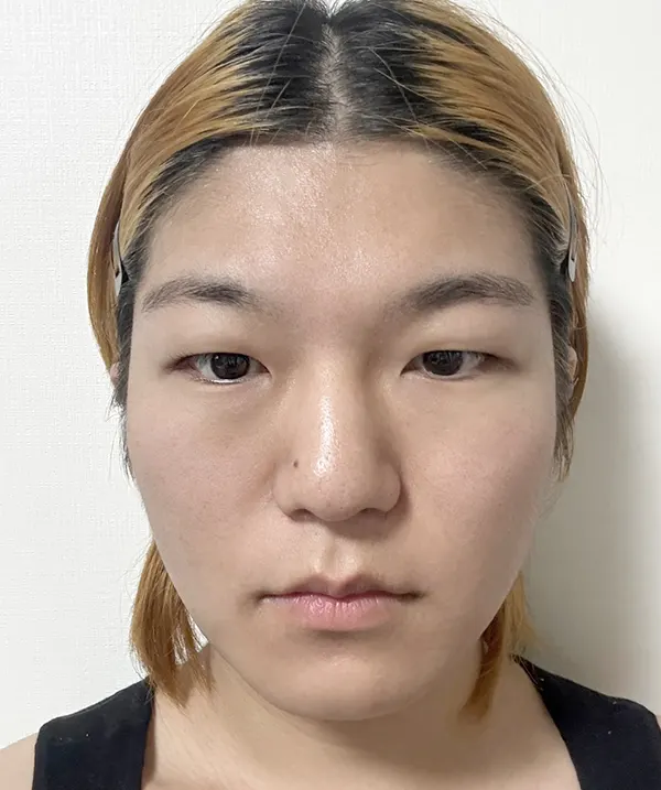 맥미걸 악플콜렉터 Before후 사진