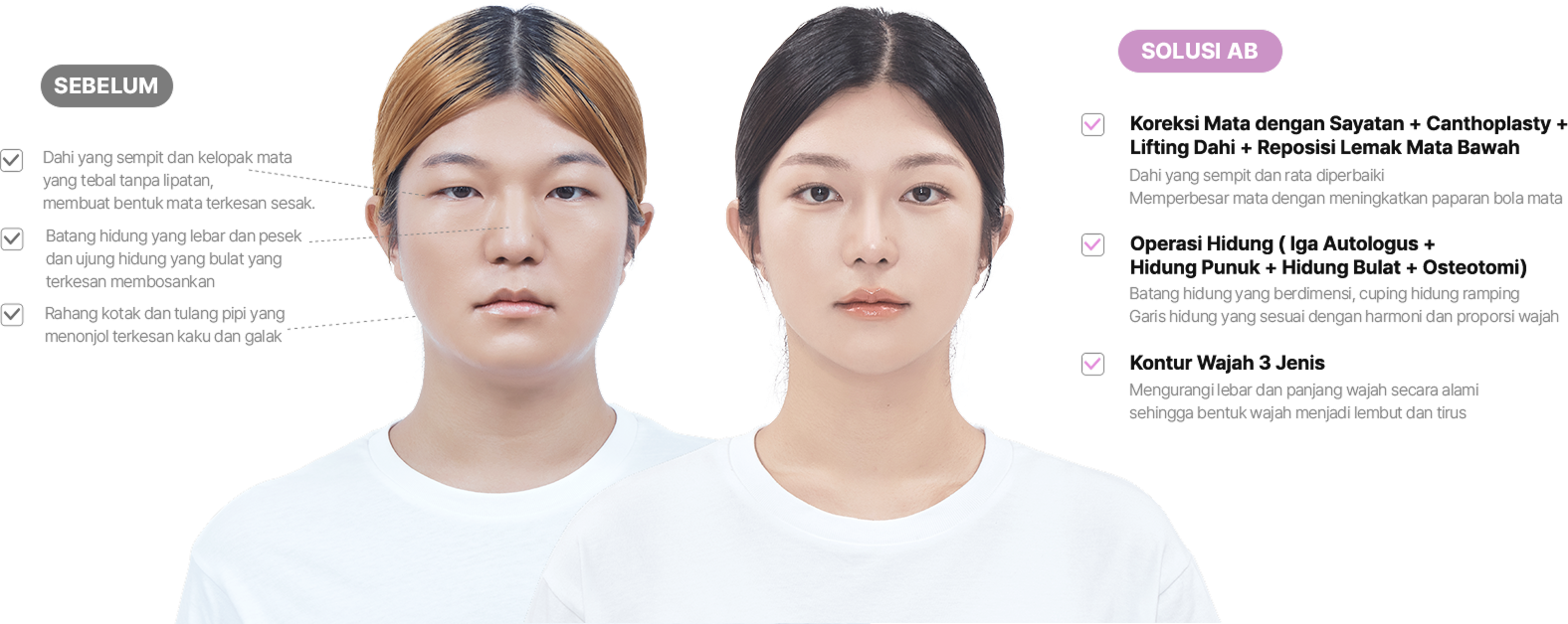 맥미걸 악플콜렉터 얼굴 수술 전 문제점과 개선점