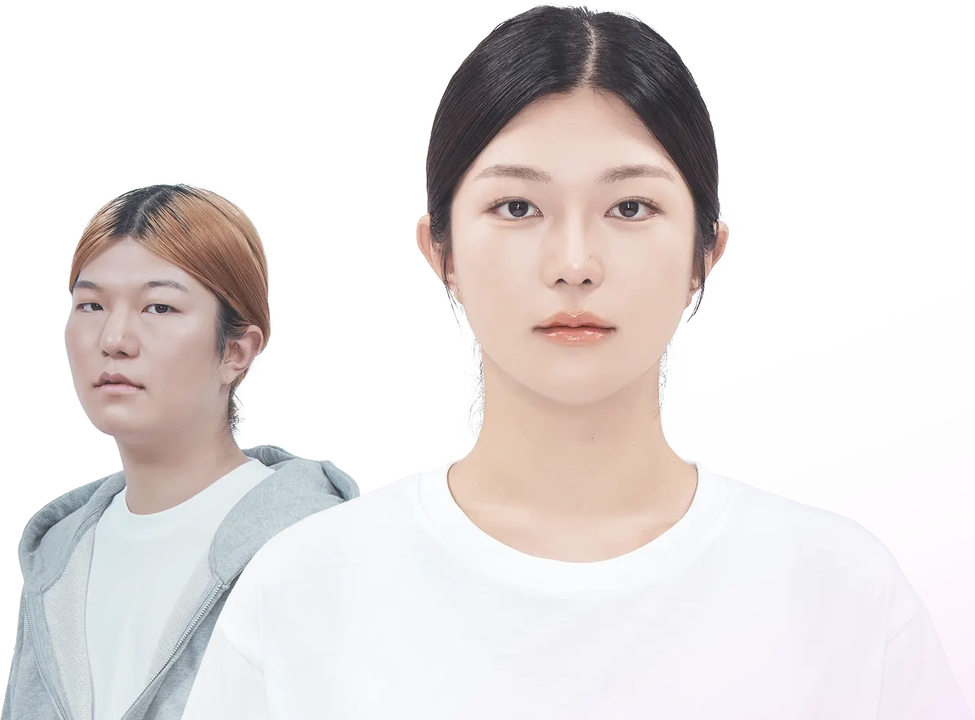 맥미걸 악플콜렉터 수술 전후 사진