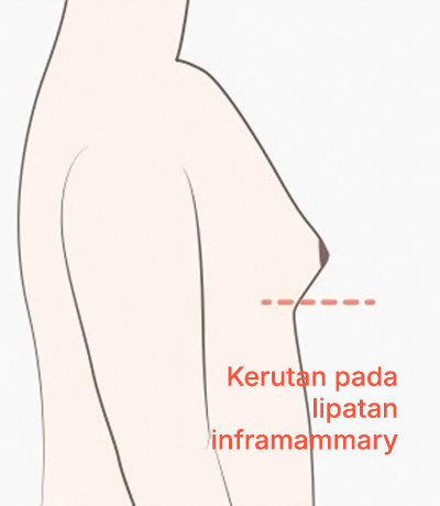 surgery_illust
