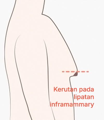 surgery_illust