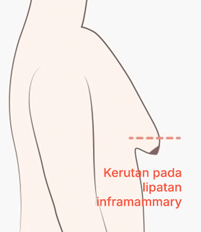 surgery_illust