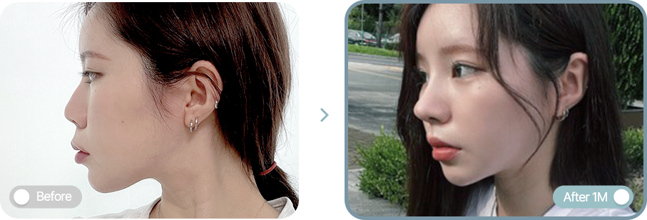AB plastic surgery
