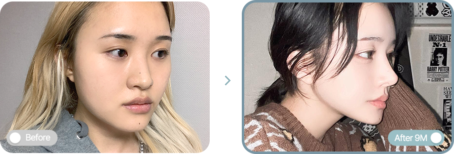 AB plastic surgery