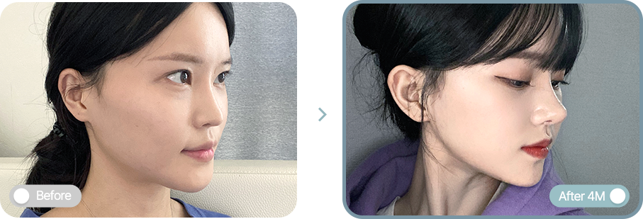 AB plastic surgery