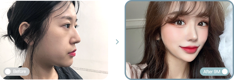 AB plastic surgery