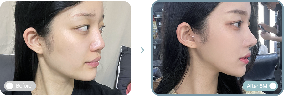 AB plastic surgery