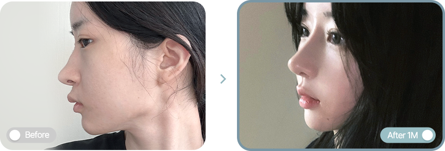AB plastic surgery