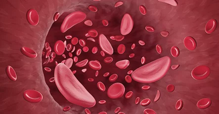 Injeksi Stem Cell Sumsum Tulang