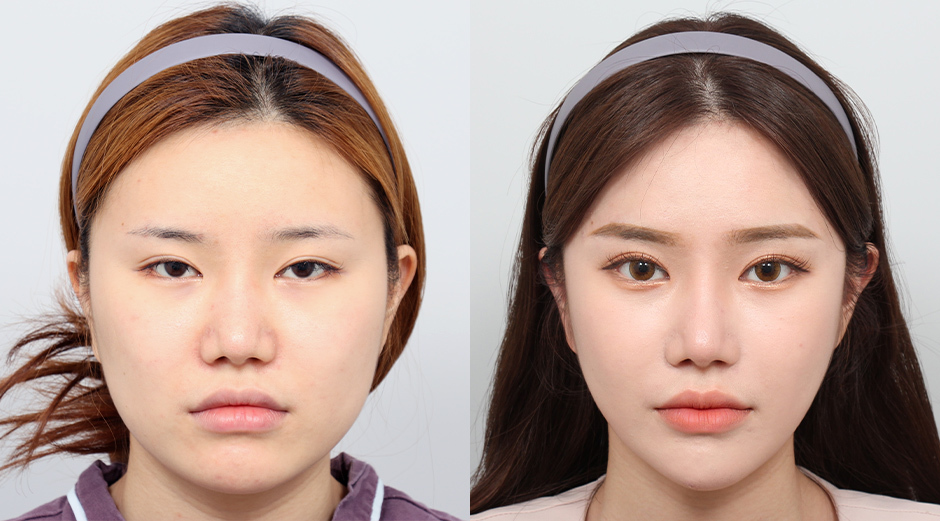 AB Plastic Surgery