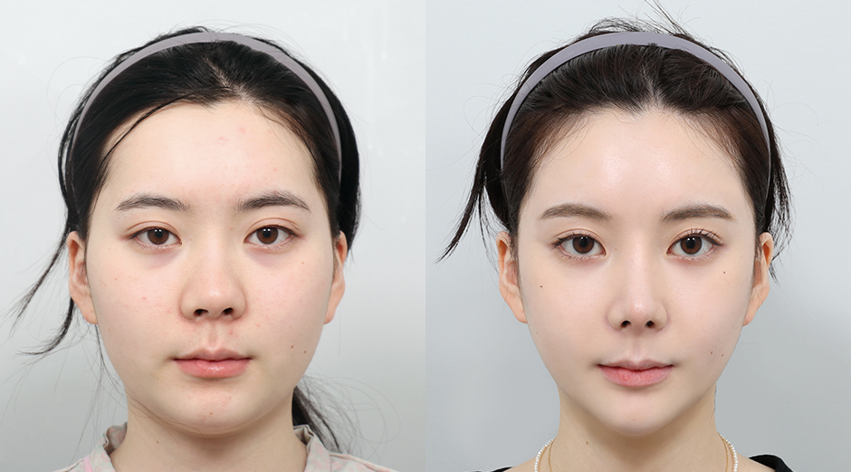 AB Plastic Surgery