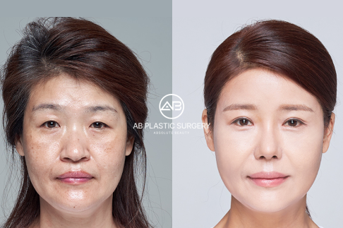 AB Plastic Surgery