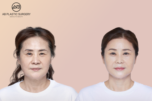 AB Plastic Surgery