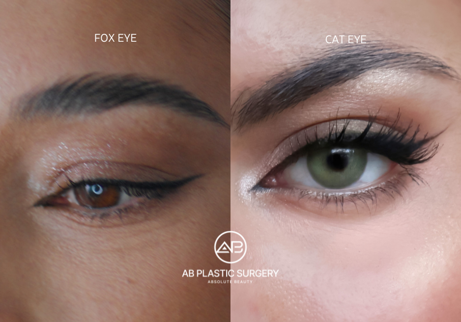 Perbedaan antara Fox Eye dan Cat Eye