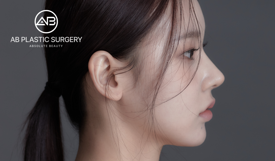 Wajah wanita Asia dengan hasil operasi plastik alami dari AB Plastic Surgery