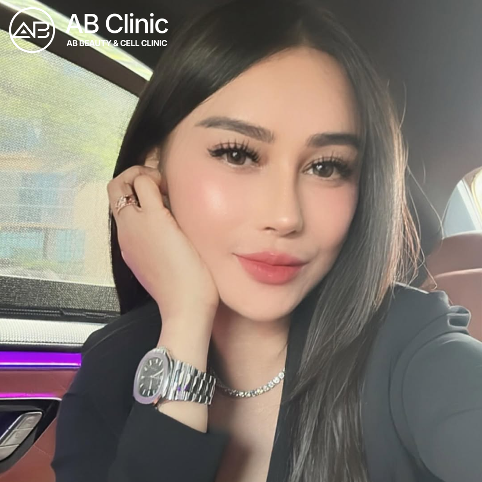 Foto before after Bebizie Fatlanay hasil skin tightening di Operasi Plastik AB Korea, perbandingan metode bedah vs non-bedah