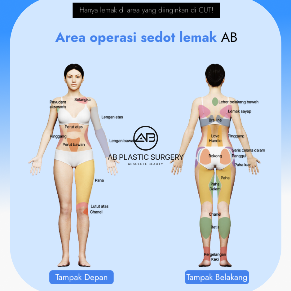Area sedot lemak tubuh di Operasi Plastik AB Korea