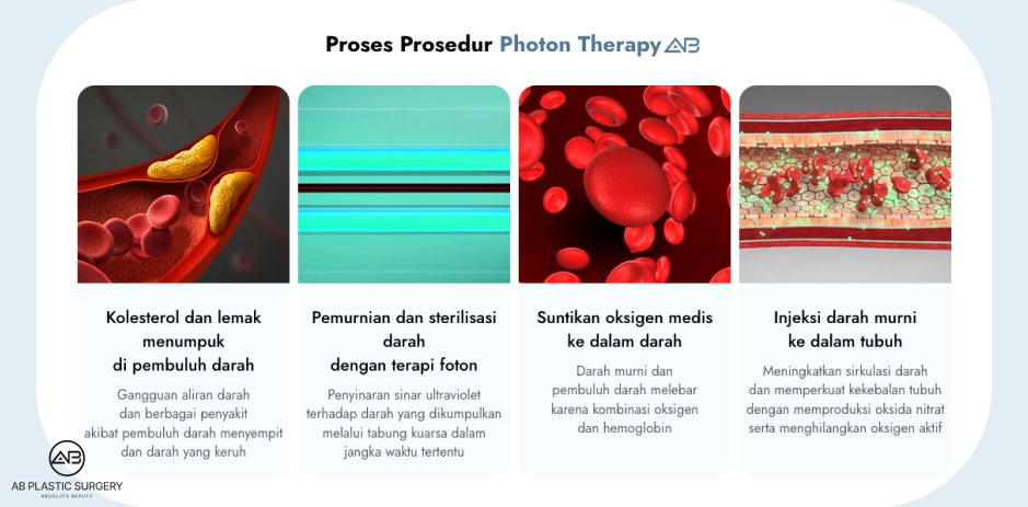 Prosedur Photon Therapy yang memungkinkan pemurnian darah, suplai oksigen, dan peningkatan sirkulasi darah