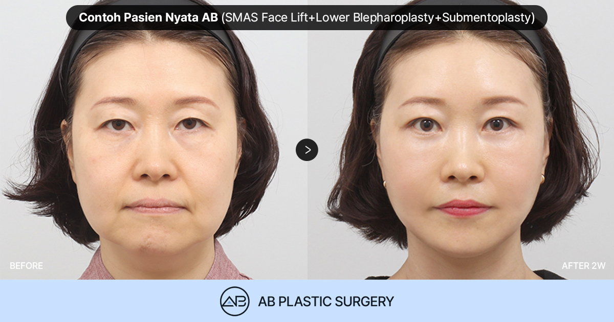 AB Plastic Surgery