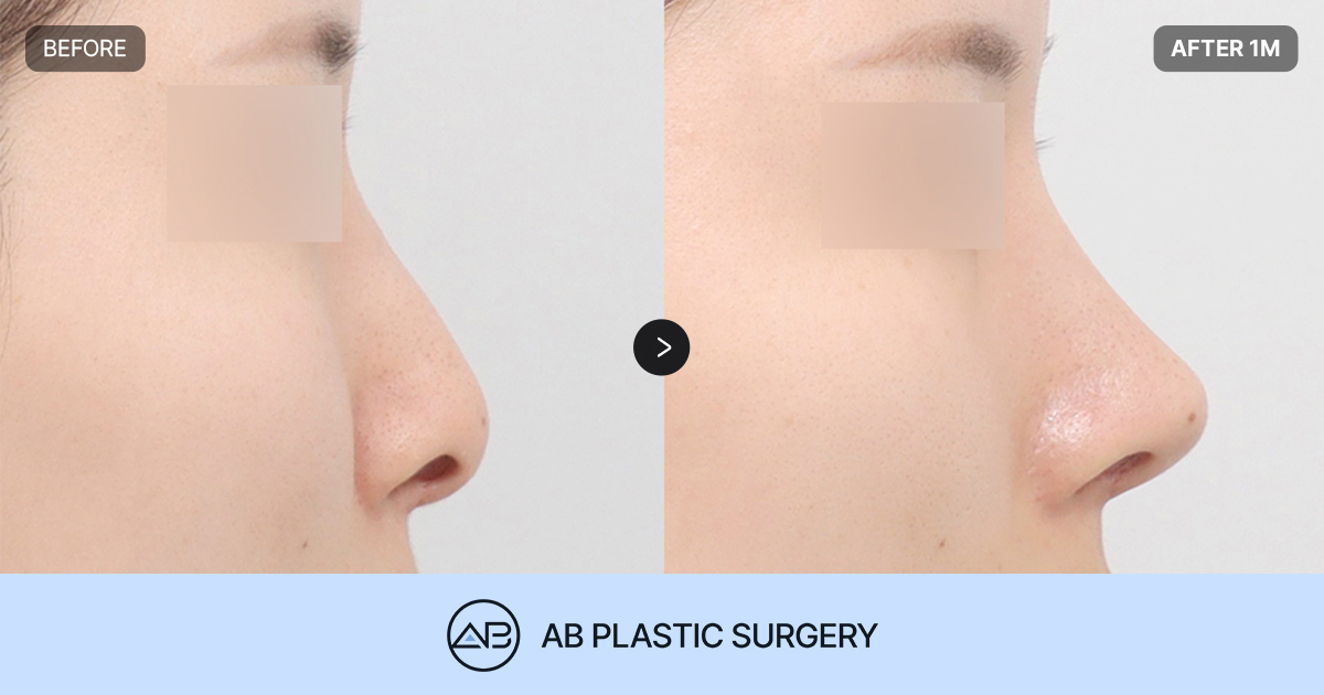 AB Plastic Surgery